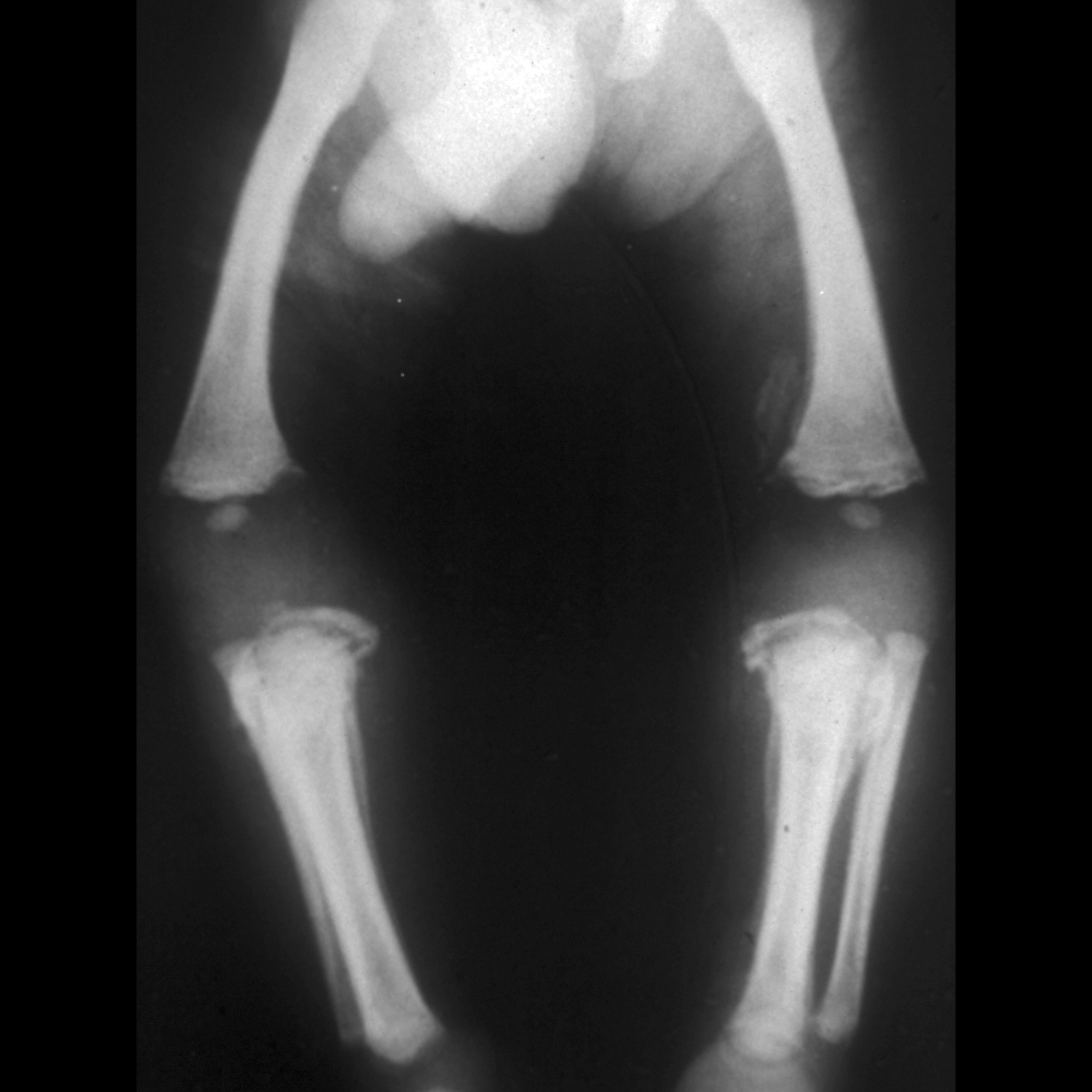 Infant with leg pain | Pediatric Radiology Case | Pediatric Imaging ...