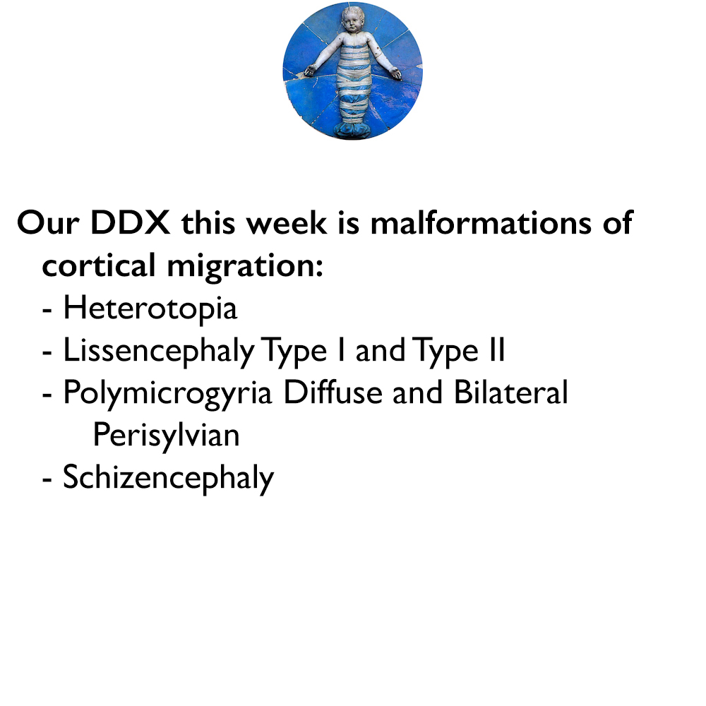 Our DDX For This Week Is | Pediatric Radiology Case | Pediatric Imaging ...