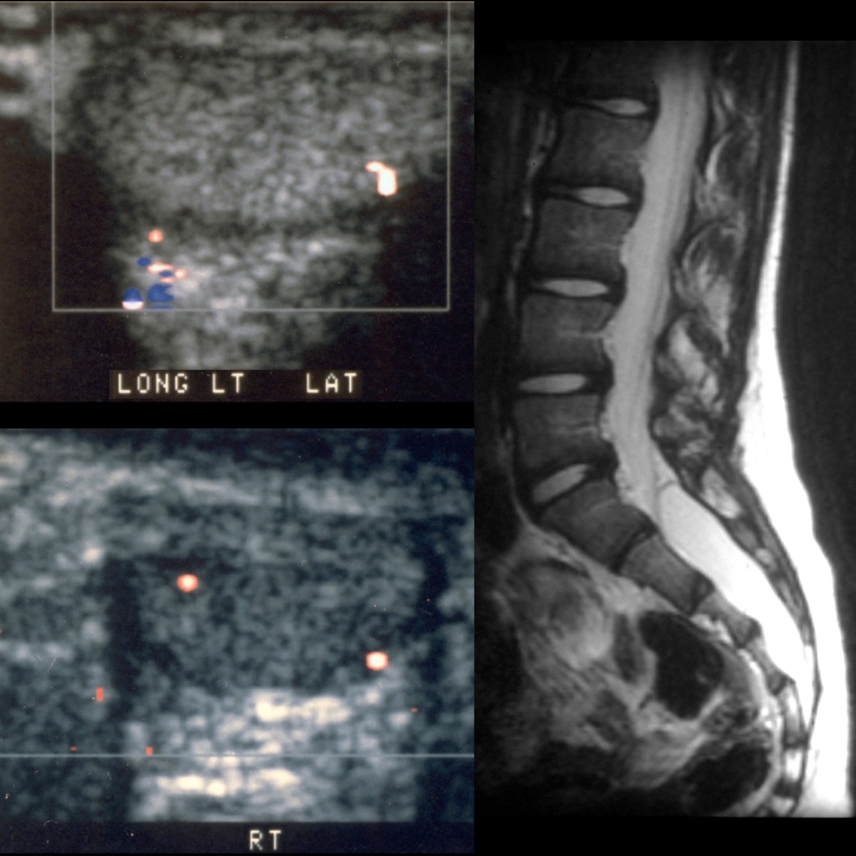 School ager with diffuse scrotal hyperesthesia and pain Pediatric